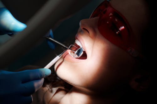 Are Veneers Your Best Option for Chipped Teeth?