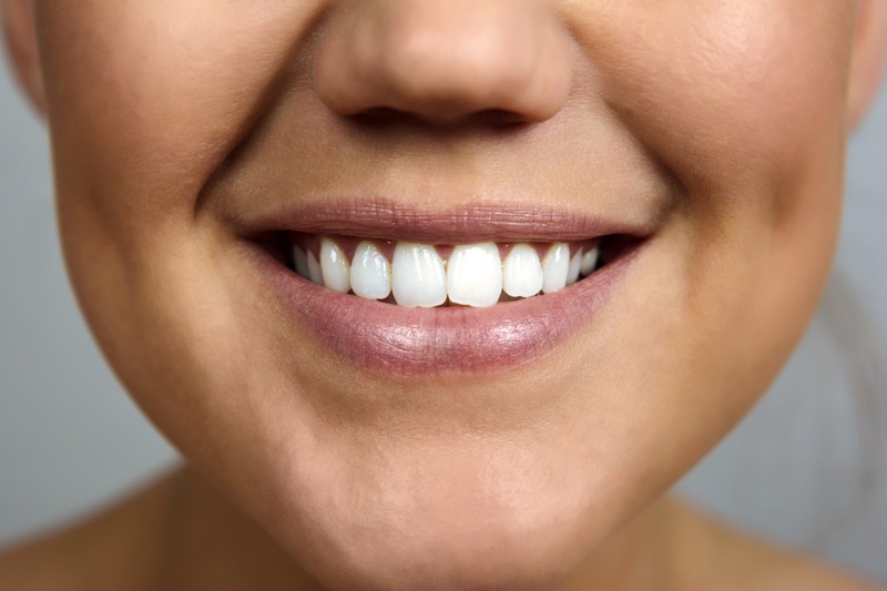 What Is the Lifespan of Dental Fillings?