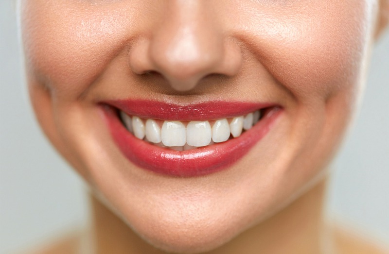 What to Expect During and After Invisalign Treatment