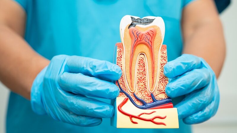 How Does Dental Trauma Affect Long-Term Oral Health